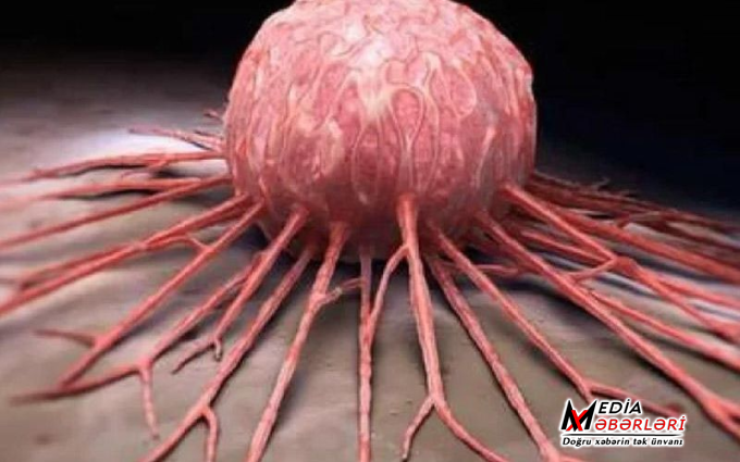 Prostat xərçənginə qarşı yeni ümid: Təsirli anticisim hazırlandı